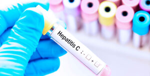 Taiwán erradica la hepatitis C: el modelo de salud que el mundo debería copiar